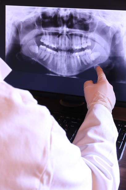 Best Emergency Root Canal Treatment in Grantley, PA